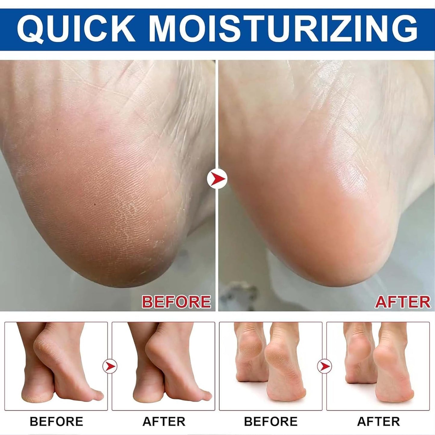 2Pcs Urea Foot Cream,Hydrating and Nourishing Foot Balm Stick,Foot Repair for Dry Skin and Rough Heels,Hands,Knees Skin Care Heel Treatment (Aloe Vera & Avocado, Scent B)