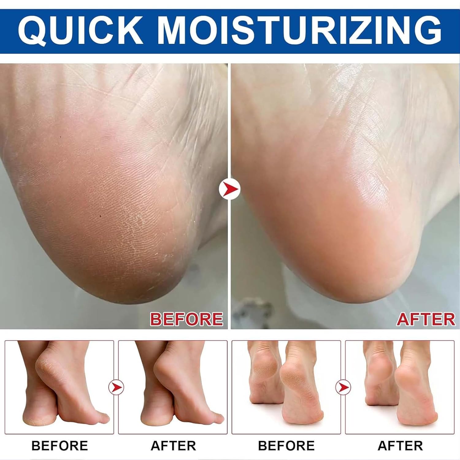 2Pcs Urea Foot Cream,Hydrating and Nourishing Foot Balm Stick,Foot Repair for Dry Skin and Rough Heels,Hands,Knees Skin Care Heel Treatment (Aloe Vera & Avocado, Scent B)